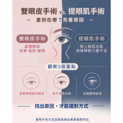 雙眼皮手術跟提眼肌手術差別
